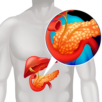 Expert Biliary Tract Disease Treatment in Thane | Tract Disease