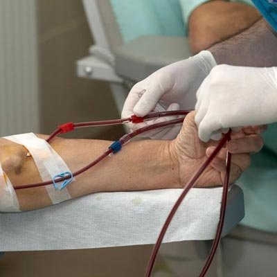 Dialysis procedure